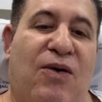 Veja o antes e o depois de Marrone após plástica no rosto