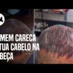 Tatuador faz sucesso por aplicar 'cabelo' em careca: 'esqueça implantes' Tatuador faz sucesso por aplicar 'cabelo' em careca: 'esqueça implantes'