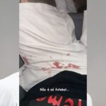 Luan publica foto com short ensanguentado após agressão de torcedores
