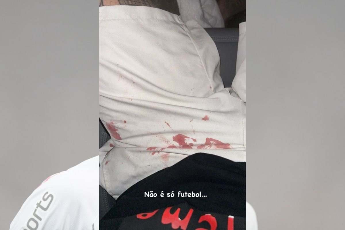 Luan publica foto com short ensanguentado após agressão de torcedores