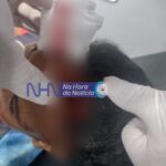 Homem é vítima de agressão física na Cidade do Povo Homem é vítima de agressão física na Cidade do Povo