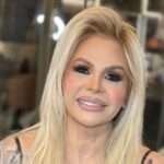 Monique Evans mostra rosto sem filtro nas redes sociais após fazer harmonização; veja