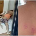 Zelador denuncia ter levado mata-leão e mordida de morador em prédio