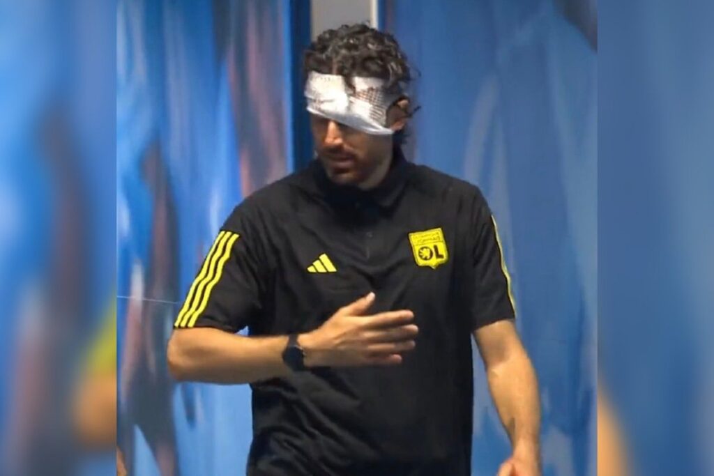 Ônibus é apedrejado antes de clássico na França e jogo é suspenso