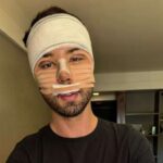 Rico desabafa após cirurgias no rosto: Rico desabafa após cirurgias no rosto: