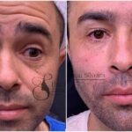 Motorista que atropelou Kayky Brito é criticado após harmonização facial; VEJA