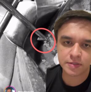 Médico do Acre alerta para a ingestão de alimentos com osso; veja um caso de obstrução