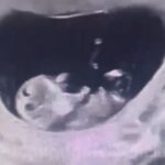 VÍDEO: marido desmaia ao ver ultrassom de mulher grávida; entenda