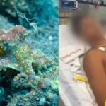 Jovem quase morre ao pegar concha que era esconderijo de polvo Jovem quase morre ao pegar concha que era esconderijo de polvo