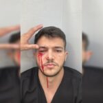 “Medo de retornar”, diz médico agredido por acompanhante de paciente