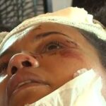 Sobrevivente de acidente que matou 24 acompanha velório da filha em maca na Bahia Sobrevivente de acidente que matou 24 acompanha velório da filha em maca na Bahia