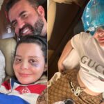 Maraisa explica acidente em que fraturou o nariz e mostra machucados Maraisa explica acidente em que fraturou o nariz e mostra machucados
