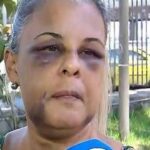 ‘Tive medo de morrer’, diz mulher espancada por lutador no RJ