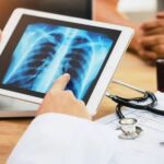 Casos de câncer vão aumentar 77% em 2050, aponta OMS Casos de câncer vão aumentar 77% em 2050, aponta OMS