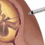 Taxa de apoio à legalização do aborto se mantém estável em 24%, revela pesquisa
