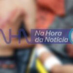 Jovem tem casa invadida e é ferido a golpes de faca na Baixada da Sobral