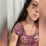 Homem que deu joelhada e soco no olho de mulher em festa é condenado