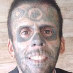 Antes e depois: homem mais tatuado do Brasil faz 2ª sessão de remoção