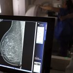 Outubro Rosa: mulheres têm exames gratuitos na rodoviária de Brasília Outubro Rosa: mulheres têm exames gratuitos na rodoviária de Brasília