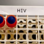 Transplantes com HIV: laboratório no RJ foi contratado sem licitação Transplantes com HIV: laboratório no RJ foi contratado sem licitação