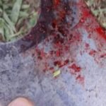 Acidente grave com roçadeira deixa trabalhador ferido em Sena Madureira Acidente grave com roçadeira deixa trabalhador ferido em Sena Madureira