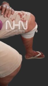 Mulher esfaqueia companheira após anúncio de separação em Rio Branco