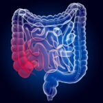Cientistas encontram vírus no intestino ligado ao câncer colorretal Cientistas encontram vírus no intestino ligado ao câncer colorretal