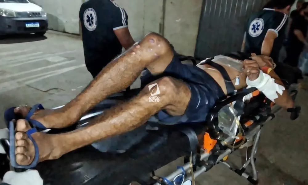 Ataque a tiros em Brasiléia (AC) deixa dois homens feridos; suspeitos fogem em motocicleta Ataque a tiros em Brasiléia (AC) deixa dois homens feridos; suspeitos fogem em motocicleta