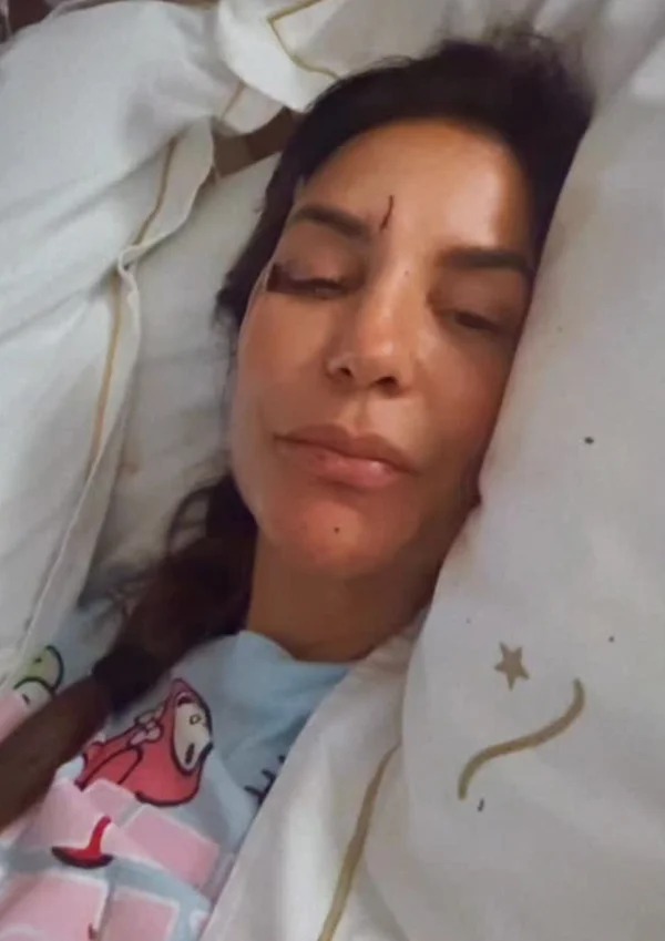 “Eu desmaiei”, diz Ivete Sangalo após sofrer acidente e ser internada