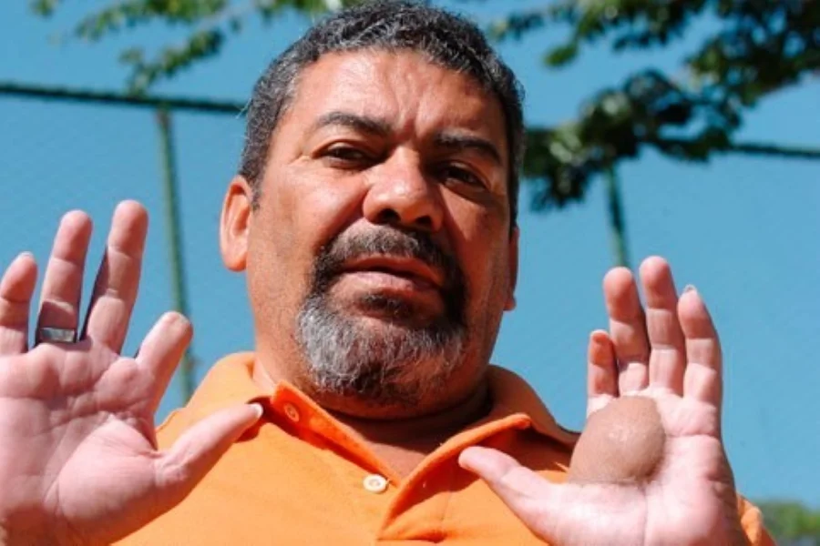 Vítima do Césio critica Netflix: história real “foi trágica por si só”