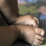 Perfil de mortes por SRAG muda no Acre: crianças e adolescentes correspondem a 52% dos óbitos