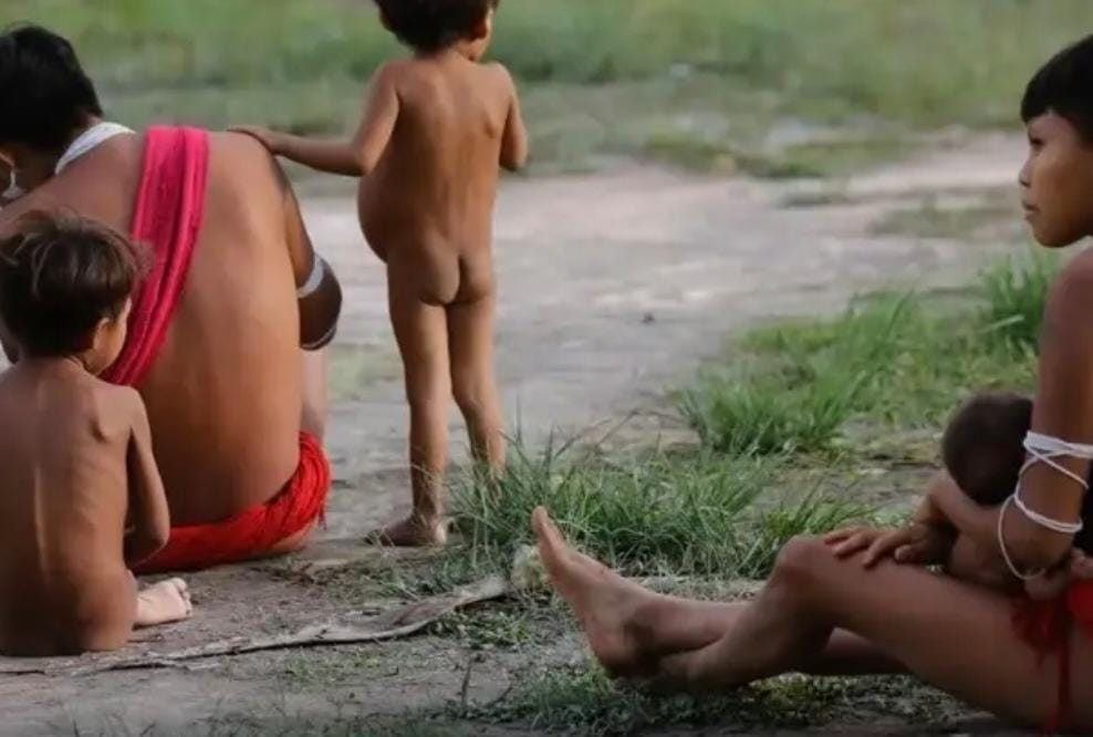 MP do Amazonas investiga falhas no atendimento a crianças Yanomami com desnutrição grave
