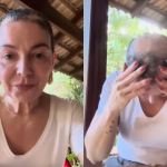 Mãe de Lucas Lucco desabafa ao anunciar a volta da alopecia areata