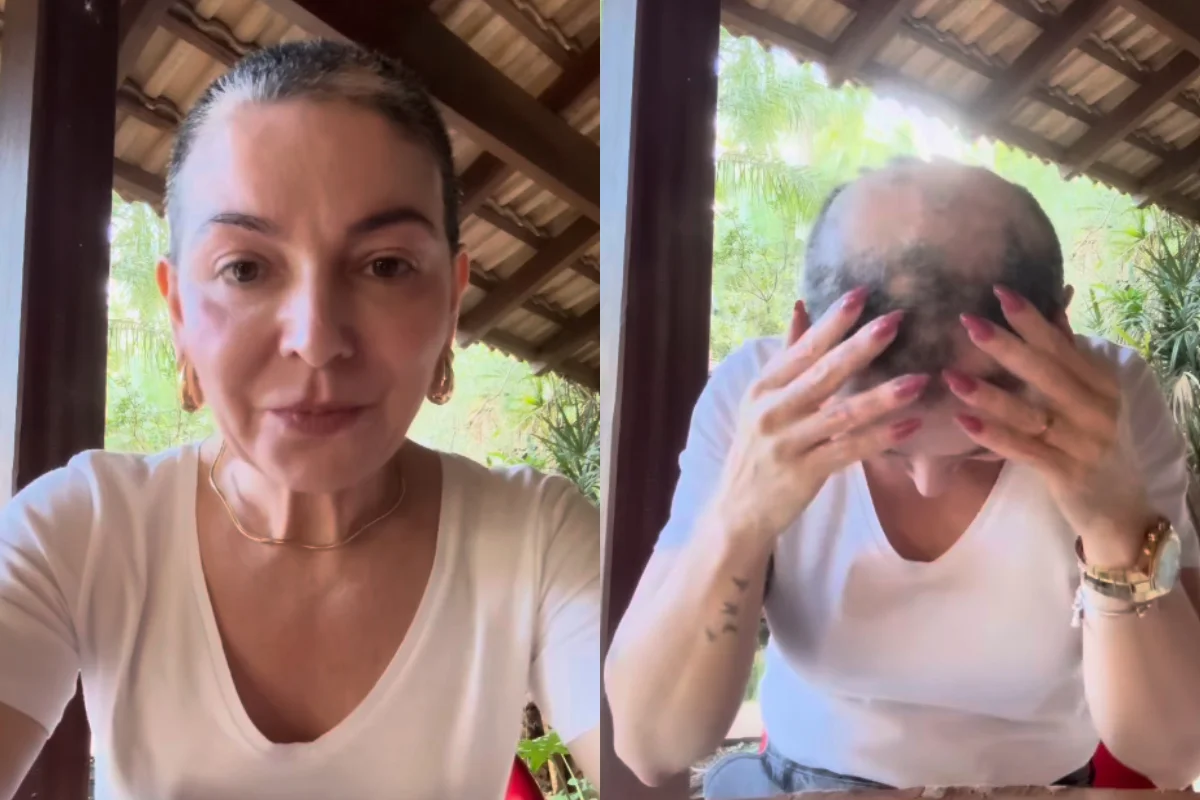 Mãe de Lucas Lucco desabafa ao anunciar a volta da alopecia areata
