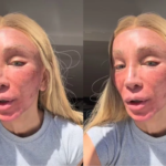 Maya Massafera mostra rosto após procedimento estético e explica motivo: 'Eu preciso fazer' Maya Massafera mostra rosto após procedimento estético e explica motivo: 'Eu preciso fazer'