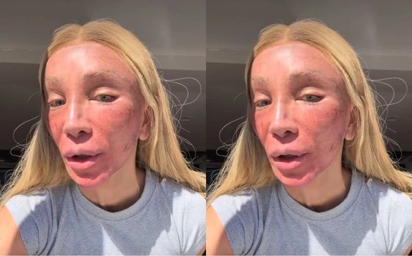 Maya Massafera mostra rosto após procedimento estético e explica motivo: 'Eu preciso fazer'