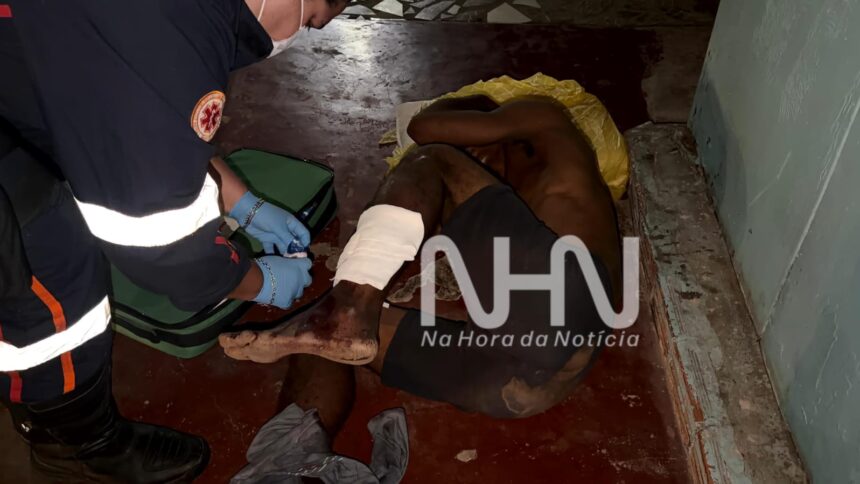 Homem é acusado de furtar drogas em boca de fumo e tem perna quebrada com fratura exposta após agressões em Rio Branco Homem é acusado de furtar drogas em boca de fumo e tem perna quebrada com fratura exposta após agressões em Rio Branco