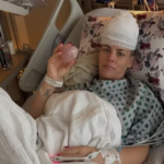 Sem sintomas, atriz de 'As Branquelas' descobre tumor cerebral raro por acaso e passa por duas cirurgias aos 47 anos
