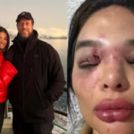 'Ele falava que ia me matar': dentista de 27 anos relata anos de agressões e violência sexual atribuídas ao marido, empresário da Faria Lima 'Ele falava que ia me matar': dentista de 27 anos relata anos de agressões e violência sexual atribuídas ao marido, empresário da Faria Lima