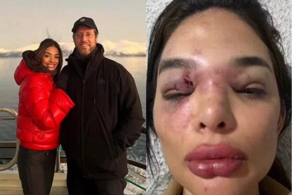 'Ele falava que ia me matar': dentista de 27 anos relata anos de agressões e violência sexual atribuídas ao marido, empresário da Faria Lima 'Ele falava que ia me matar': dentista de 27 anos relata anos de agressões e violência sexual atribuídas ao marido, empresário da Faria Lima