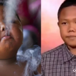 Menino que fumava 40 cigarros por dia e reapareceu aos 18 anos começou a fumar com 18 meses