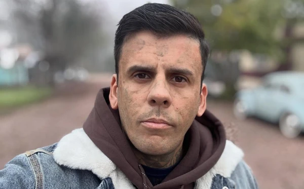 Ex-homem mais tatuado do Brasil vai passar por cirurgia após descobrir problema de saúde Ex-homem mais tatuado do Brasil vai passar por cirurgia após descobrir problema de saúde