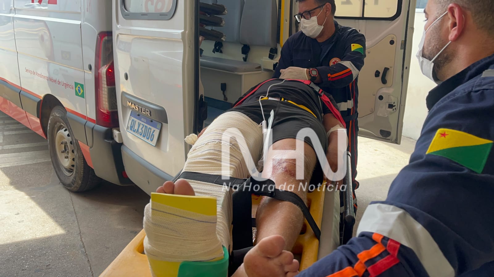 Colisão entre duas motocicletas deixa dois homens com fraturas na Baixada da Sobral, em Rio Branco Colisão entre duas motocicletas deixa dois homens com fraturas na Baixada da Sobral, em Rio Branco